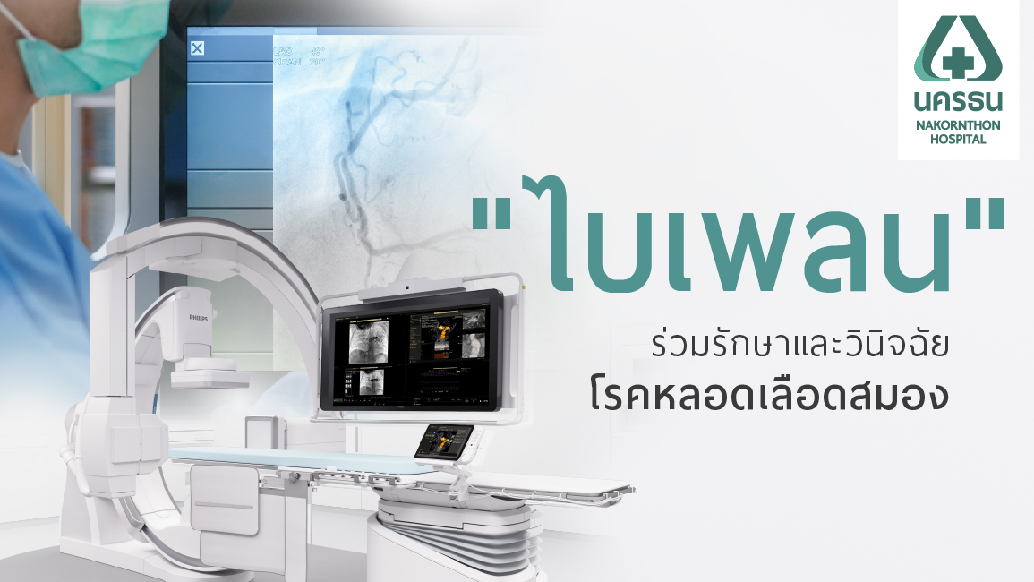 รังสีร่วมรักษาและวินิจฉัยโรคหลอดเลือดสมอง ด้วย ไบเพลน (Biplane Angiography)